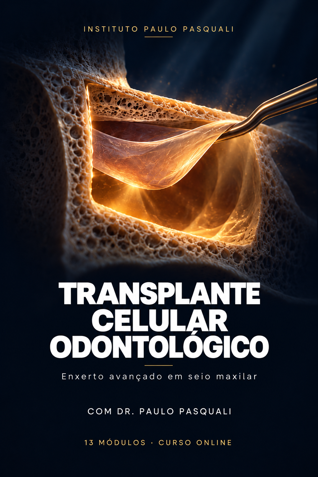 Transplante Celular Odontológico — Enxerto avançado em seio maxilar