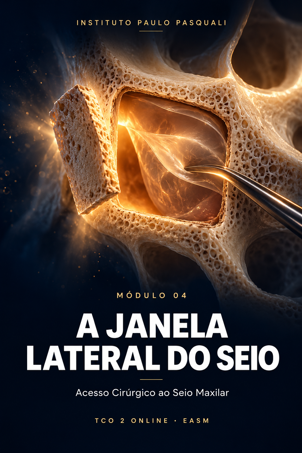 Módulo 4 — Anatomia e acesso ao seio pela janela lateral