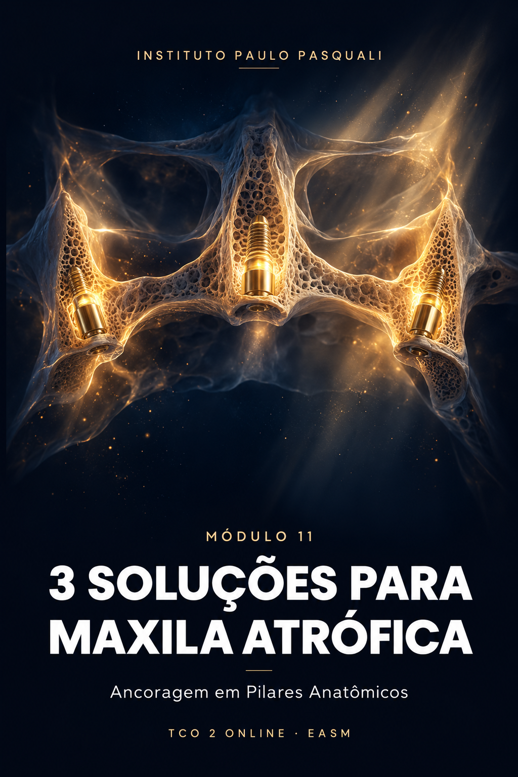 Módulo 11 — Três soluções para maxila atrófica